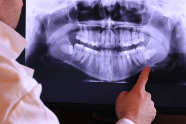 Best Knocked-Out Tooth Emergency  in Marshall, IL