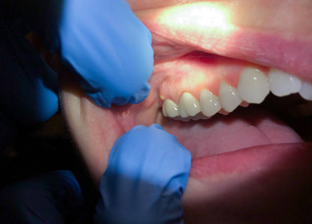 Best Emergency Gum Pain Relief  in Marshall, IL