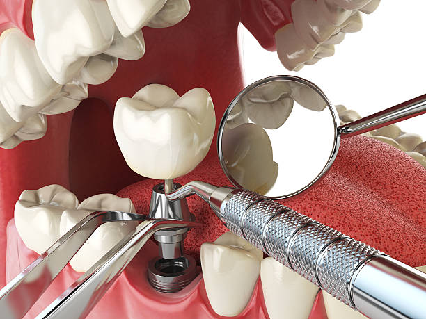 Best Emergency Tooth Extraction  in Marshall, IL