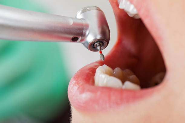Best Urgent Tooth Repair  in Marshall, IL
